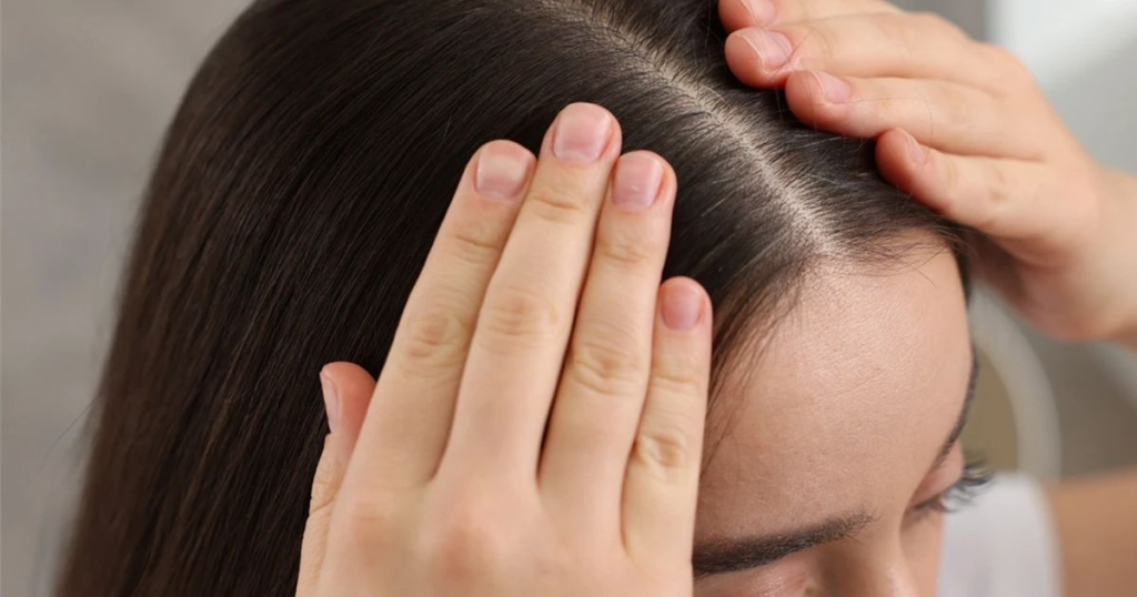 Dandruff and healthy scalp care tips for 2026