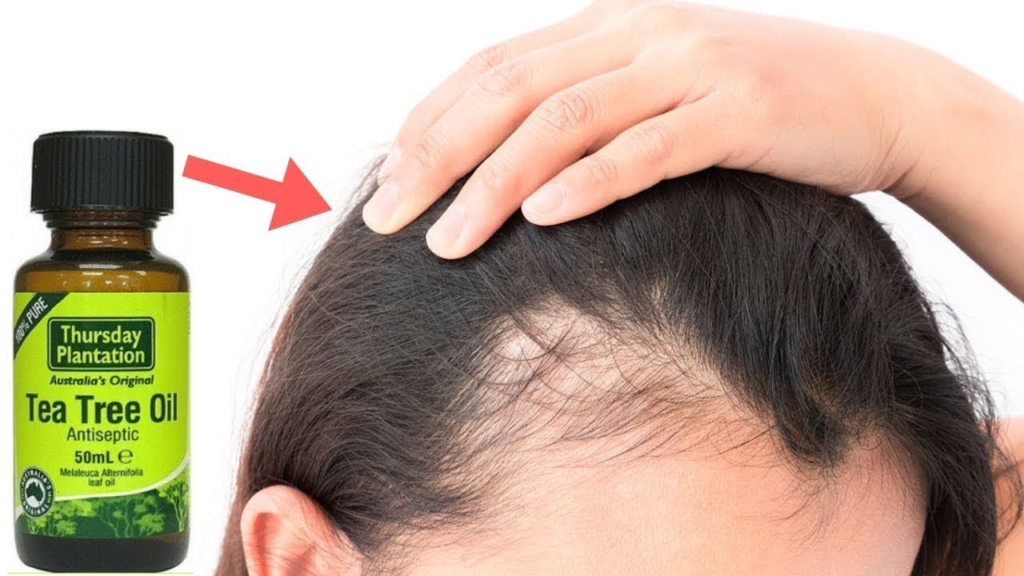 Dandruff and healthy scalp care tips for 2026